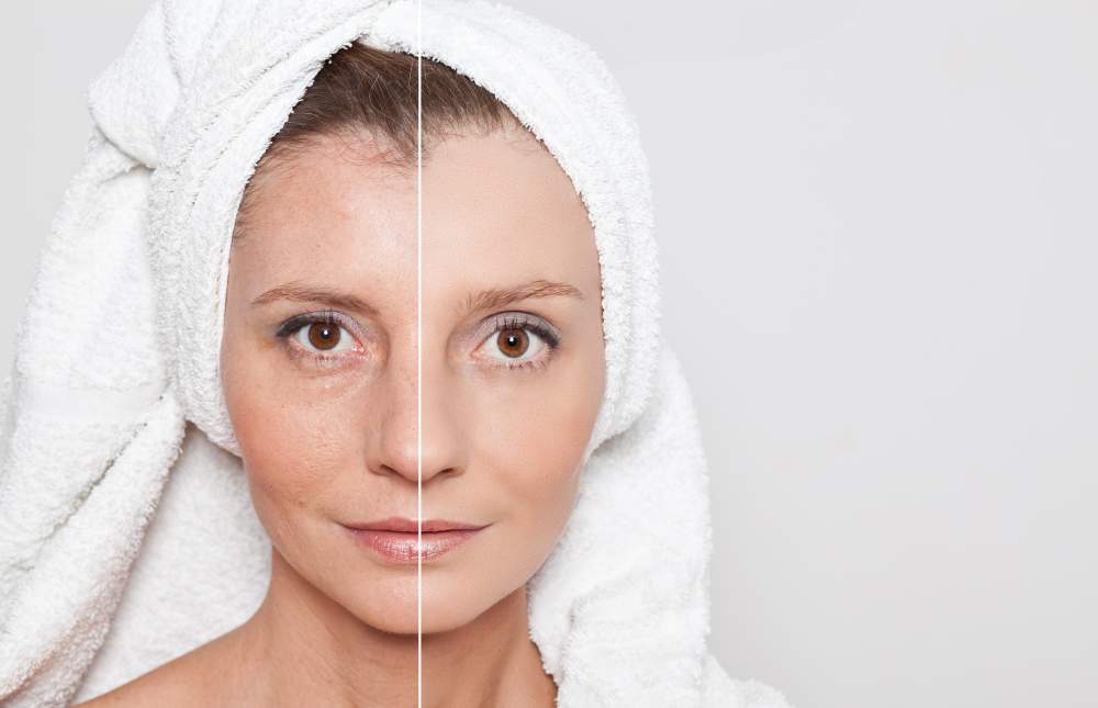 bigstock-wrinkles-before and after woman