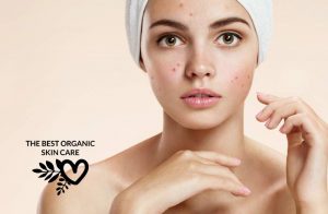 best facial oils for acne skin