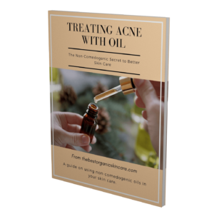 Treating Acne with Oil Ebook 3D cover (1)
