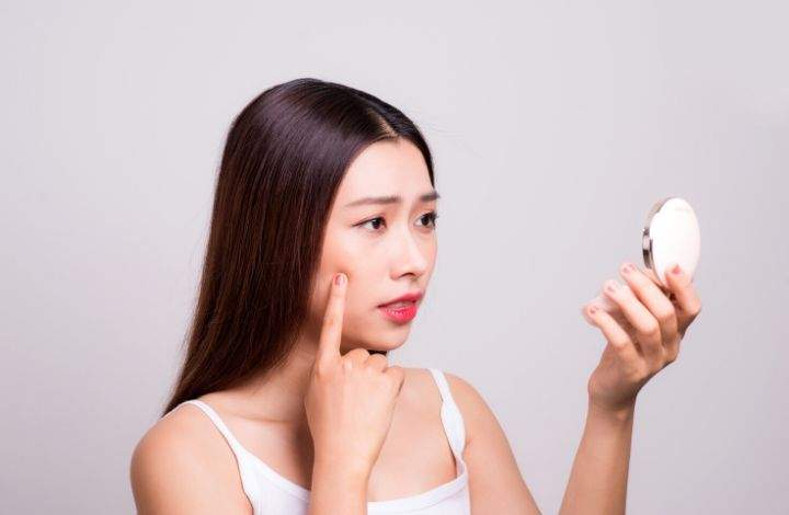 Benefits of Using DIY Acne Spot Treatments