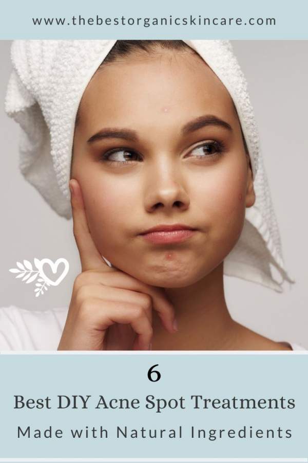 best DIY acne spot treatment recipes