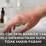 Ciri-Ciri Skin Barrier Yang Perlu Diperhatikan Supaya Tidak Makin Parah!