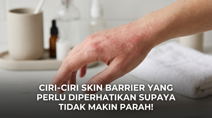 Ciri-Ciri Skin Barrier Yang Perlu Diperhatikan Supaya Tidak Makin Parah!
